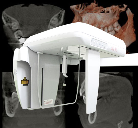 精密治療を叶える歯科用CTやマイクロスコープなどの機器