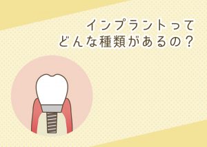 インプラントってどんな種類があるの？柏市の歯医者が教えます！