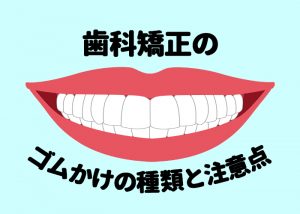 柏市の方必見！歯科矯正のゴムかけの種類と注意点は？