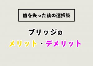 歯を失った後の選択肢であるブリッジのメリット・デメリットについてご紹介します