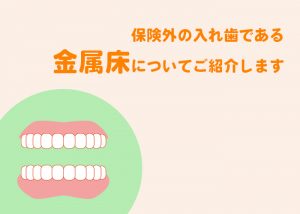 ●保険外の入れ歯である金属床の種類についてご紹介します