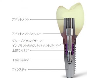 当院で使用しているカムログインプラントシステムについて