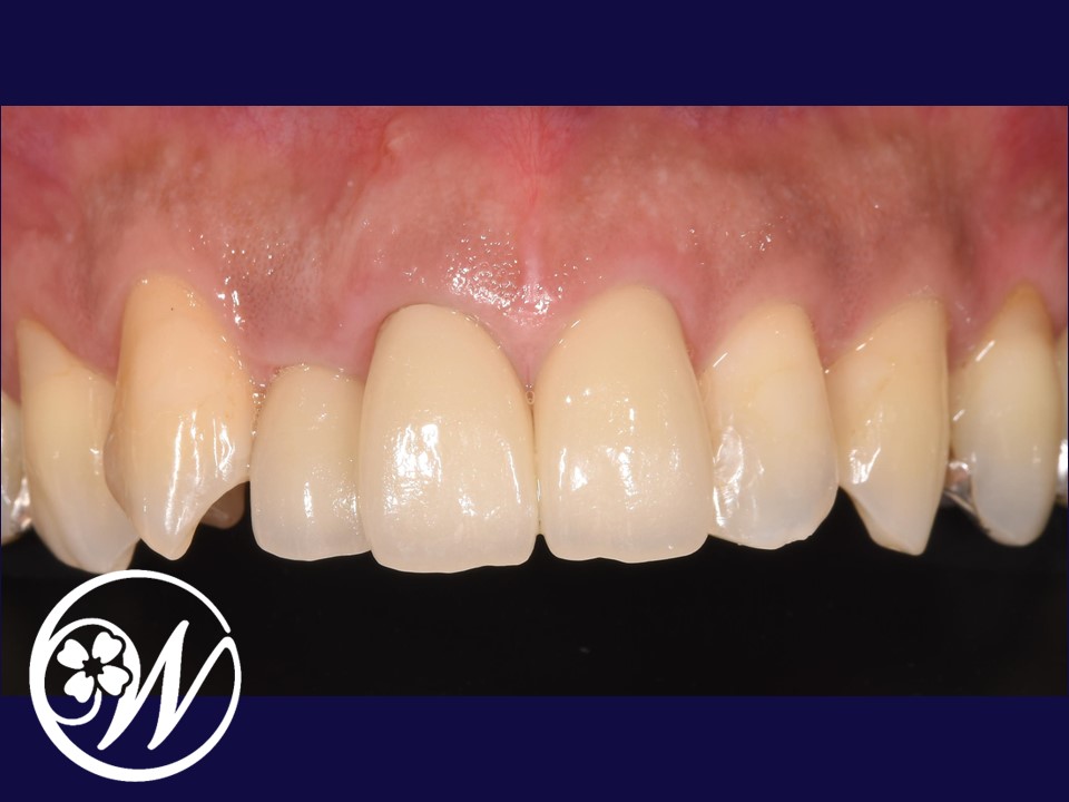 5. ペパーミントエッセンシャルオイル