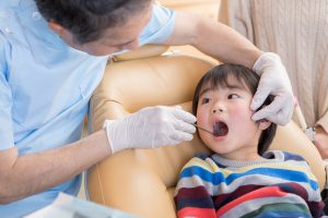 歯科医で口を開けて検診をしている子供